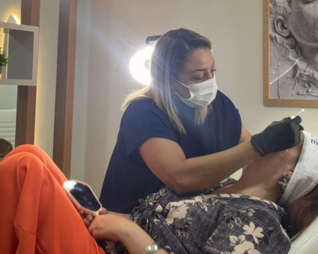 Sessão de Preenchimento Facial em Goiânia com Dra. Raquel Brito.